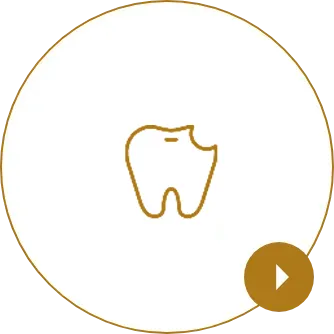 詰め物・被せ物が取れた